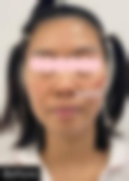 临床实例分享：治疗成效如何？