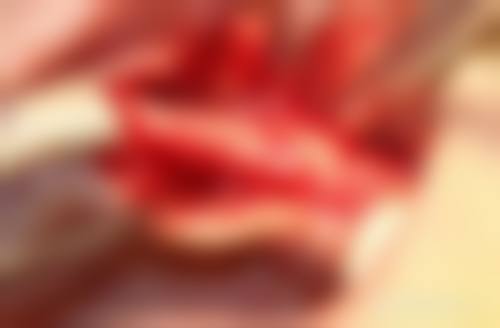 患者真实评价：口碑背后的信任力量