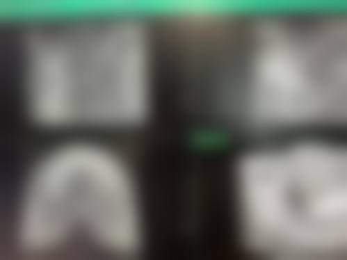临床实例分享：袁苏健+核心项目