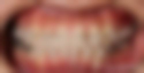 患者真实评价：王辉医生口碑汇总