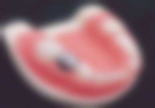 透明价格与优惠活动