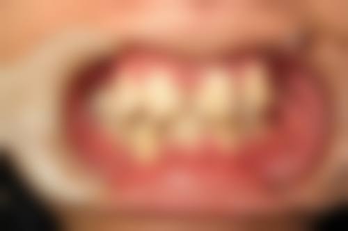 结尾预约号召：立即行动，开启美丽蜕变