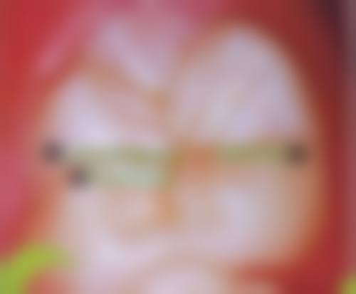 八、山东临沂牙尔乐口腔怎么预约?