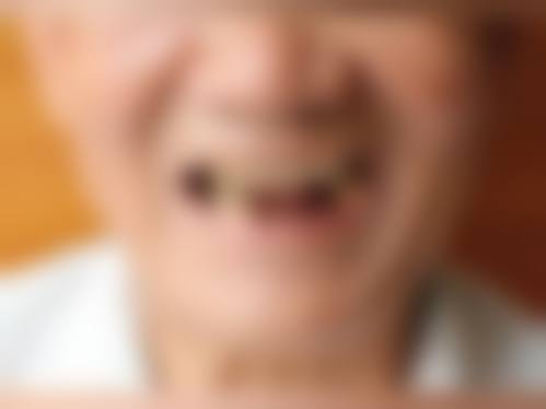 黄石大众口腔医院王小永医生口碑评价及真人实例反馈