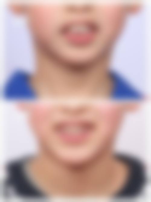 贲学明医生口碑评价及真人实例反馈
