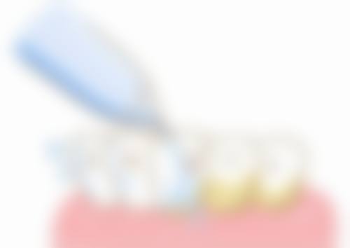 七、陕西安康汉阴思迈尔口腔地址电话及营业时间