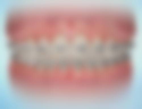 六、陇南禾苹口腔口碑如何?