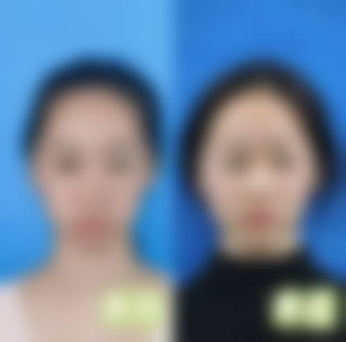 优惠活动详情与价格透明化确保